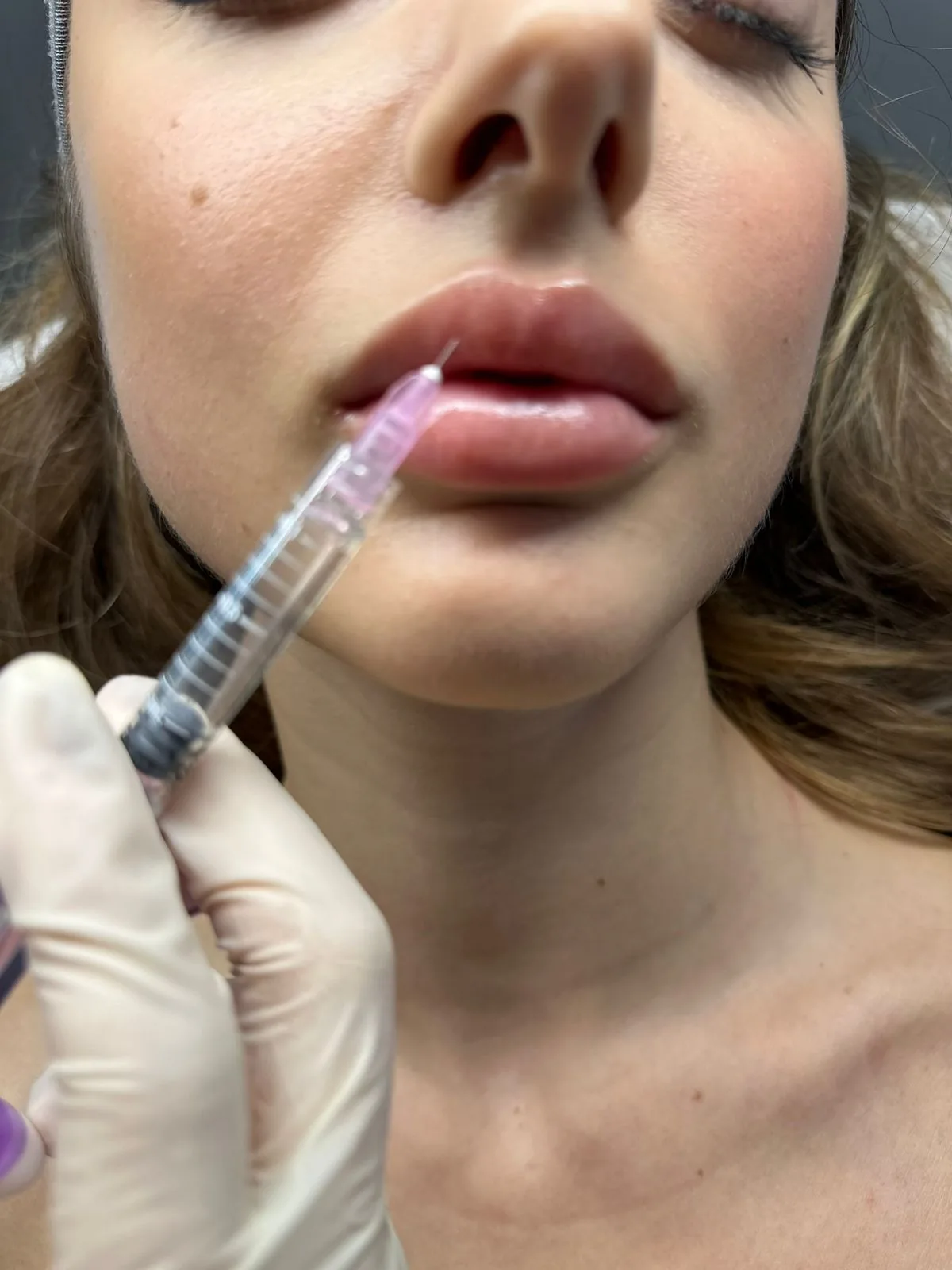 Fillers